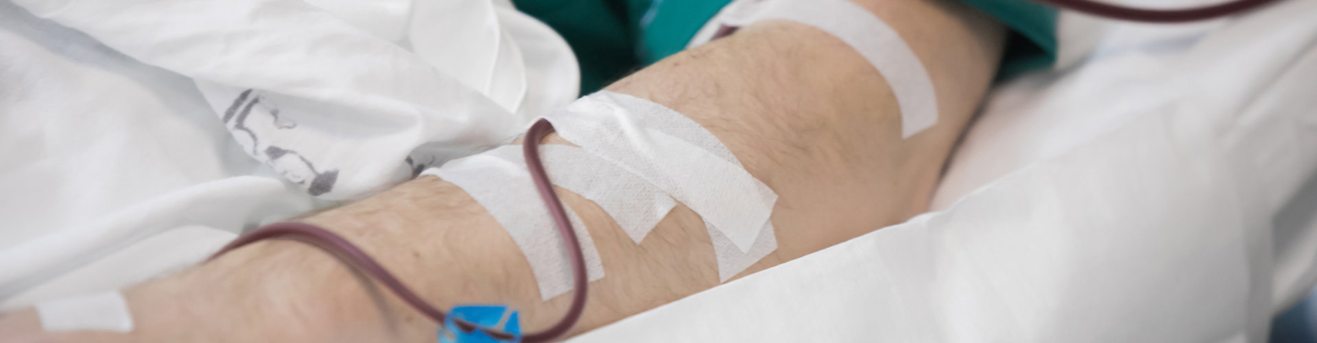 Hemodialysis machines with tubing.,transplantation,medical equipment concept.