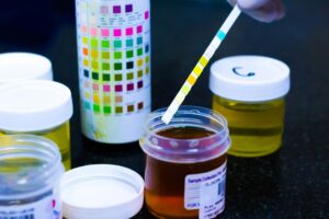 Proteinuria: What is It and How it Affects Kidneys